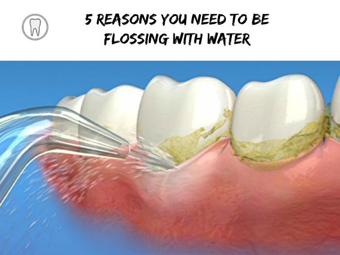 5 reasons to use a water flosser