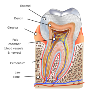 Gingivitis